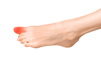 Big toe pain, joint ache, and inflammation. Sore foot with sprain, tendon bruise, and calcaneal contusion. Chronic arthritis, muscle strain, and neuropathy. Treatment and therapy