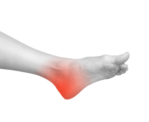 Foot pain, heel ache, joint problem, and neuropathy symptoms. Red, swollen feet with muscle strain and injury. Treatment for arthritis, gout, and osteoporosis. Medical care for