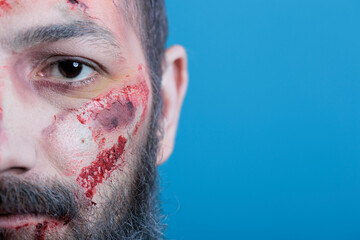 Portrait of wounded man full of blood, victim of bullying, feeling defenseless. Close up shot of...