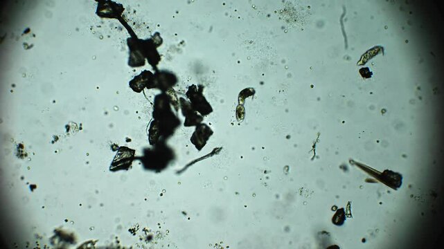 Close-up of rotifers swimming in microorganism-rich water, observed through a microscope, highlighting their intricate movements and internal processes.