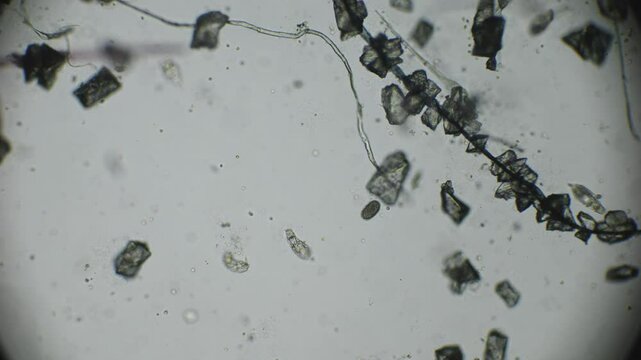 Microscopic view of rotifers in their natural environment, showing internal movements as they swim in water filled with microorganisms and organic debris.