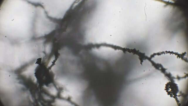 Black mold on bread observed under a microscope, revealing detailed spore structures on a light background with clear, thread-like filaments.