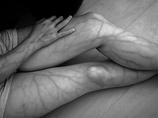 Infrared Photography at 850nm of a Woman's Thighs Revealing Veins Beneath Her Skin