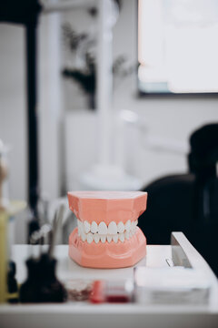 Dental model on clinic tray showcasing oral health care tools