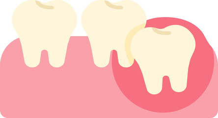 wisdom tooth removal remove discomfort pain oral dental care health