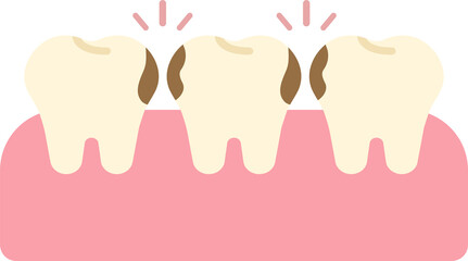 hidden cavity caried tooth caries carious tooth dental oral care