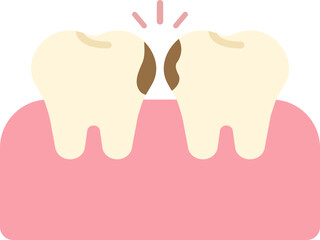 hidden cavity caried tooth caries carious tooth dental oral care