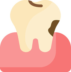 tooth cavity caries carious tooth cavity treatment root canal treatment