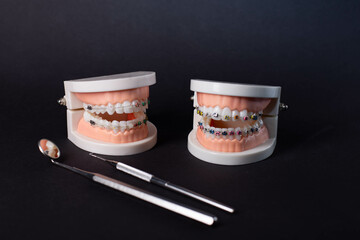 Dentist's work in dental office, showing jaw with braces. Orthodontic treatment, dental care concept