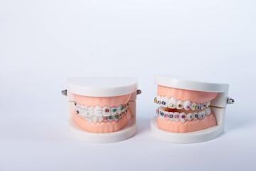 Orthodontic tools, brace, bracket system, tooth