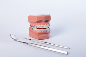 dental model with braces - Teeth orthodontic dental model with dental braces