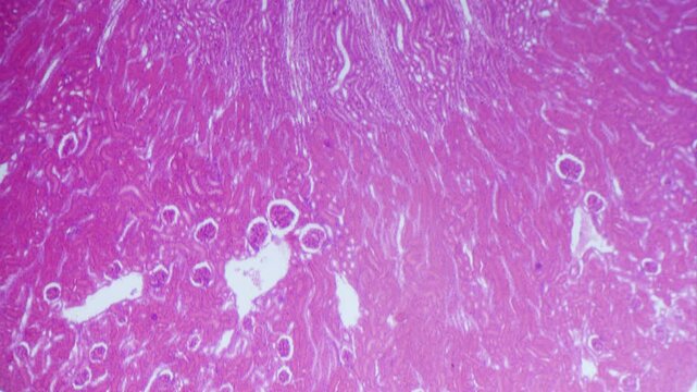 Kidney longitudinal section under microscope 4x objective bright field