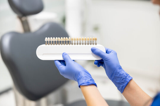 The image depicts a dentist holding a tooth shade guide in a clinic, essential for matching and selecting tooth colors during dental restoration processes.