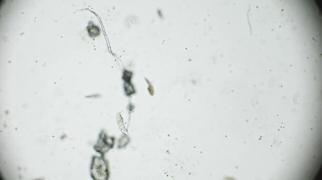 Rotifers captured under a microscope, revealing their internal structures as they move through contaminated water searching for food.