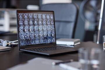 Background shot of neurologists laptop showing computed tomography imaging of human brain on screen...
