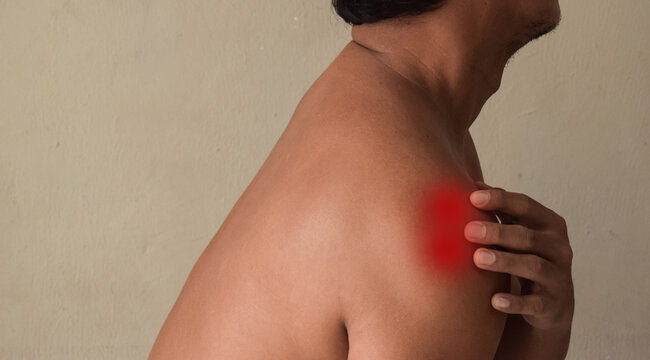 Arthritis and muscle pain relief cream concept. Man having shoulder and arm pain at home