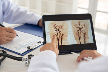 Doctor radiology team looking brain x-ray image mra for diagnose ischemic stroke or hemorrhagic stroke cerebrovascular disease at hospital.