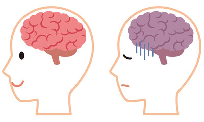 元気な脳とストレスを受けた脳　脳のイメージ　健康