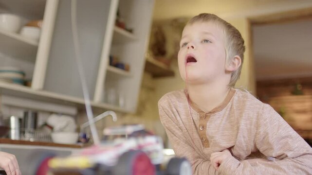 Boy surprised as tooth is pulled out using string attached to RC car