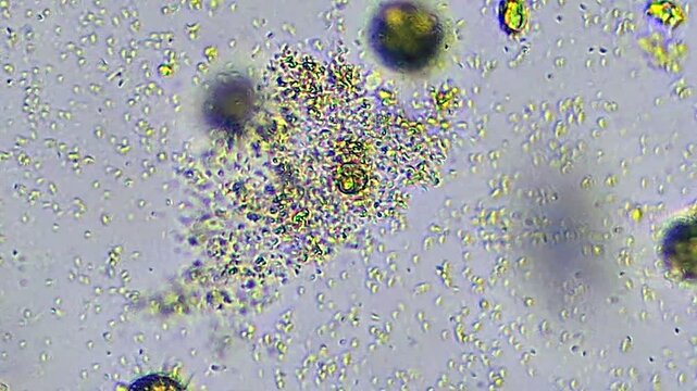 Microorganisms under microscope. Zoom. Multitude Organisms Unicellular. Funny observation
