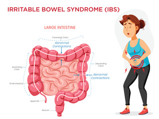 Irritable Bowel Syndrome Visualizing Symptoms with an Intestine Diagram