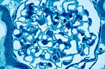 Kidney glomerulus