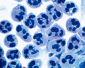 Polymorphonuclear leukocytes