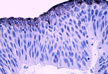 Transitional epithelium. Keratin