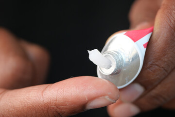 Applying cream or ointment using a tube can provide effective relief