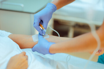 Medical Assistant inserting IV Cannula to a Patient for Treatment. Woman getting intravenous therapy for dehydration 
