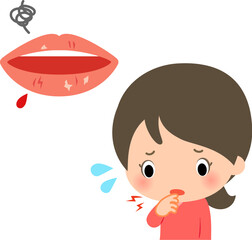 唇が荒れて困っている女性