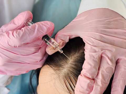 Cosmetologist does prp therapy against hair loss and anti-dandruff of a beautiful brunette woman in a beauty salon concept