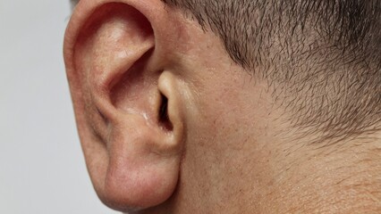 Obraz premium close up of a person with a headache,generative ai