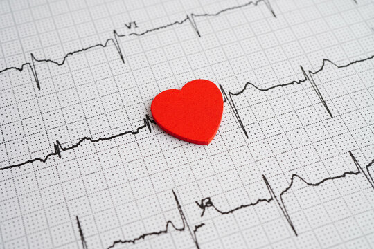 Electrocardiogram (ECG), heart wave, heart attack, cardiogram report.