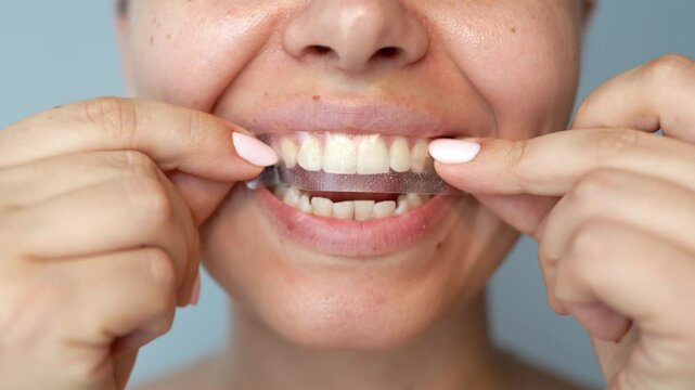 Close up of a young caucasian woman applying a 3d transparent teeth whitening strip to get rid of the dark yellow plaque on a grey background. Dentistry, dental care