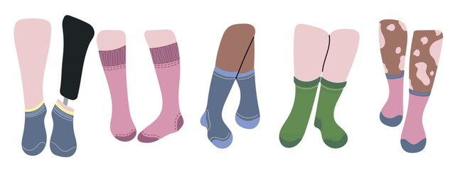 Five pairs of socks design on legs. Concept diversity white, black color skin, vitiligo, inclusive person with prosthetic leg. Blue, pink, green, yellow socks. Low cut, ankle, knee high, over the calf