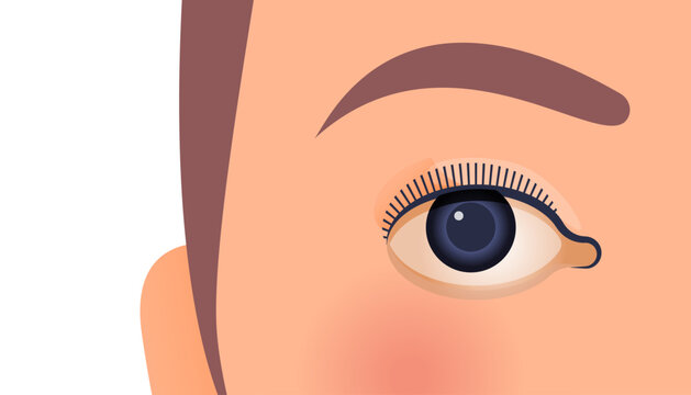 Ophthalmology. Modern Flat Vector Illustration. Female's Eye. Social Media Template.