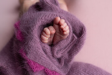 the legs of the newborn baby. the legs of the newborn flaky skin. peel off the skin. peeling skin newborn. newborn child. feet