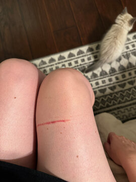 woman's legs with a large scratch from a kitten,  is on the floor 