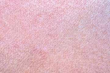 dry and dehydrated human skin texture background