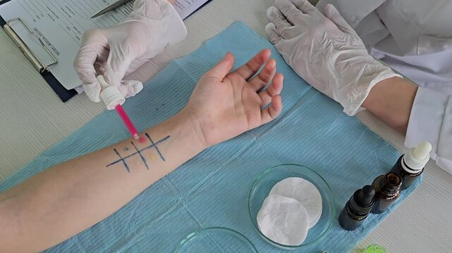 Allergen skin test procedure and detailed process