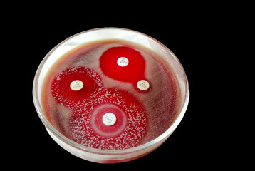 Antimicrobial susceptibility testing in petri dish. Microbiologist check Antibiotic resistance of...