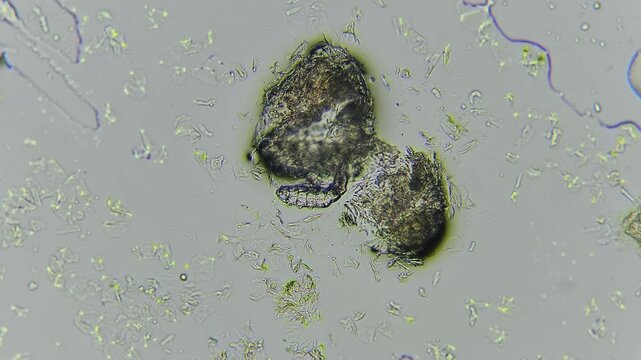 Demodex on dog's skin video taken with microscope under big magnification	
