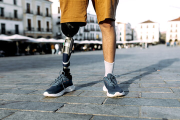 Man with prosthetic leg standing on city street in summer