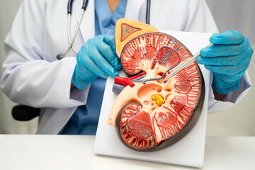 Chronic kidney disease, doctor with model for treatment urinary system, urology, Estimated...