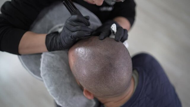 Technician practicing the scalp micro-pigmentation on a male customer in the hair-clinic