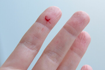 Close-up of a woman's hand with a cut on finger with a little blood