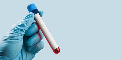 Blood sample in test tube in doctor's hand