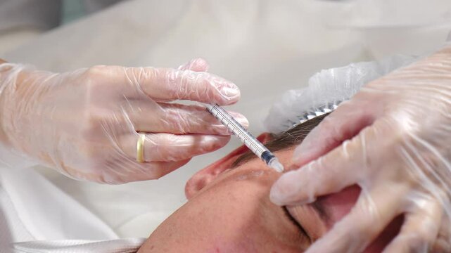 Beautician wearing latex gloves injects male patient forehead, targeting skin rejuvenation and wrinkle reduction for a more youthful look. Modern beauty clinic. antiage treatment. Closeup shot