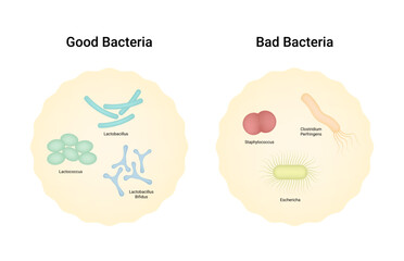 Difference between Good Bacteria and Bad Bacteria